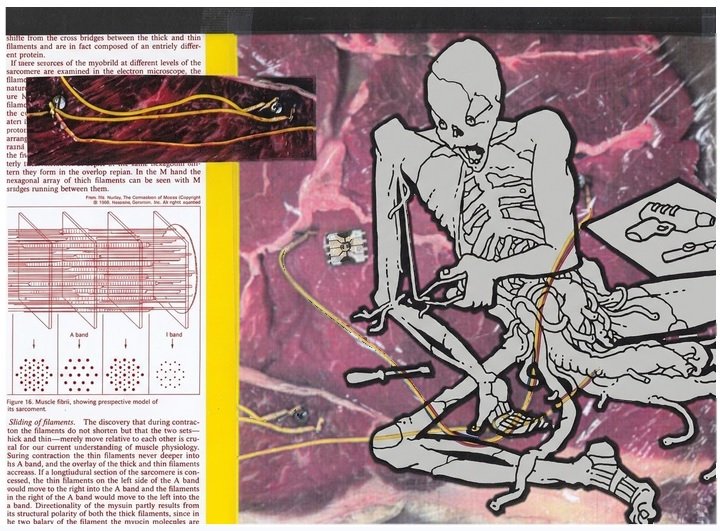 Badly damaged body rebuilds itself (redacted version)